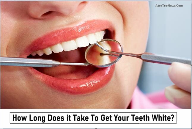 how long does it take to get your teeth white